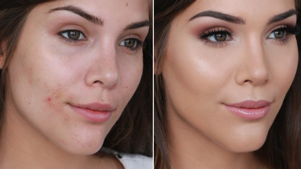 How-to-conceal-pimples-with-makeup